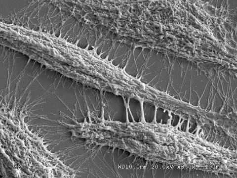 Scanning electron image of osteoblasts